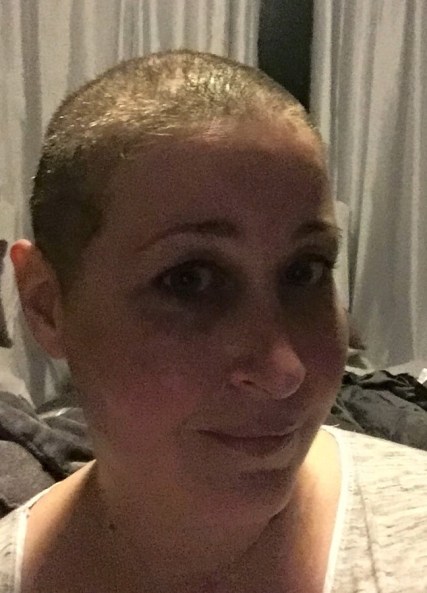 bald ellie